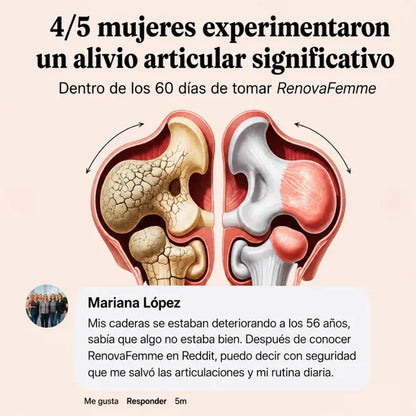 Renovafemme – Movilidad y confort articular en la menopausia