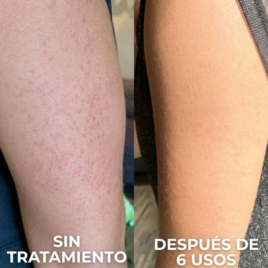 SEDÉ — Crema Suavizante para Piel Áspera y Granitos