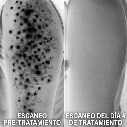 SEDÉ — Crema Suavizante para Piel Áspera y Granitos