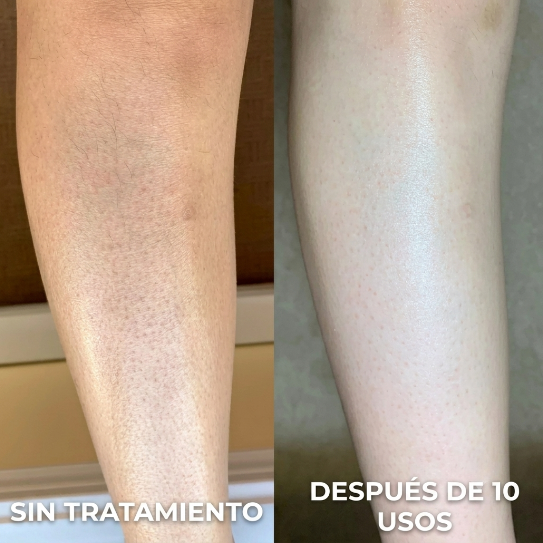 SEDÉ — Crema Suavizante para Piel Áspera y Granitos